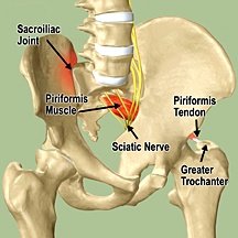 1 Sacroiliac SI Joint Belt  Coccyx Tailbone Pain Relief