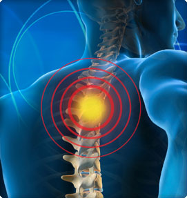 Two Types of Upper Back Pain | How They Impact Your Life
